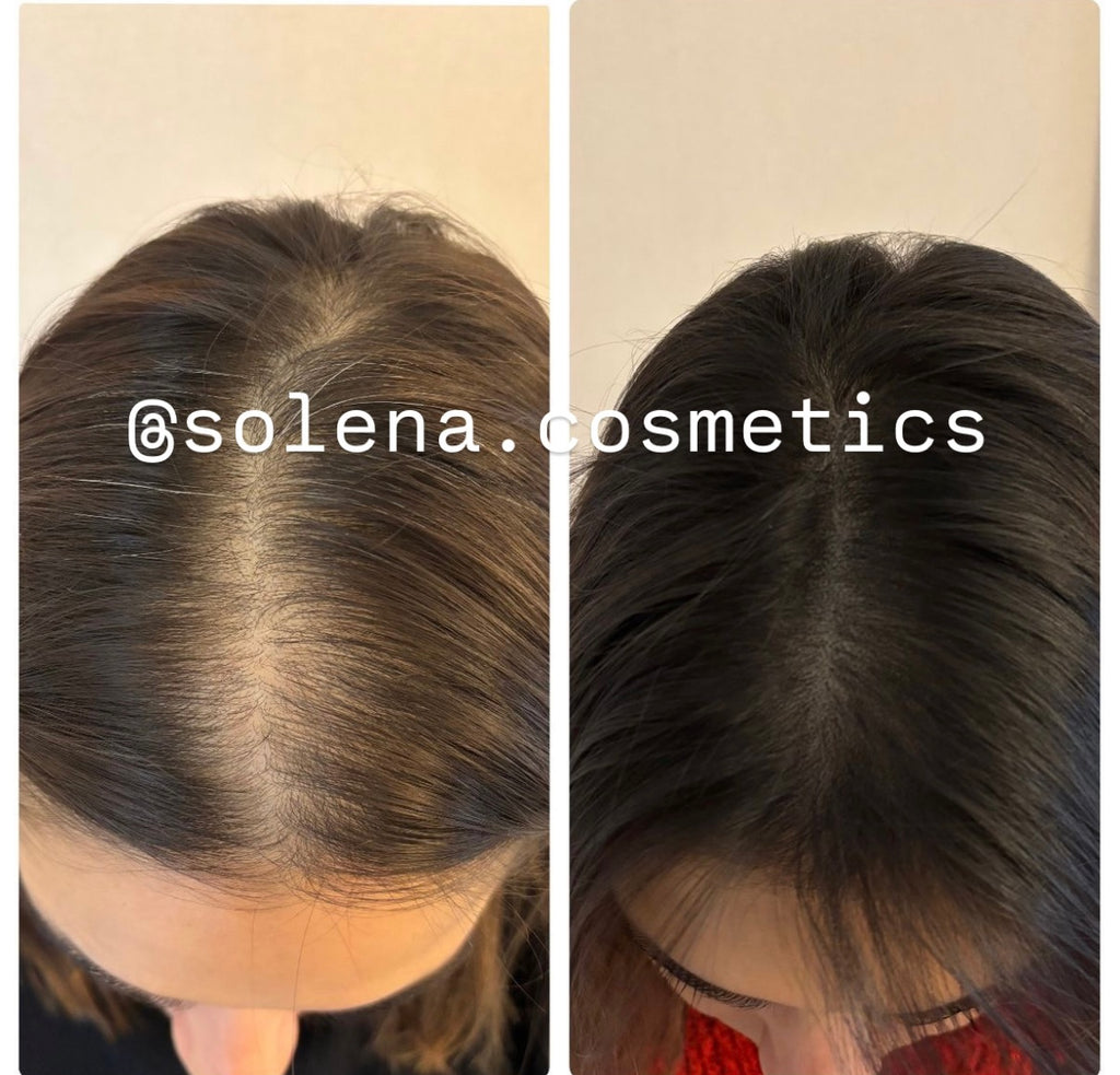 Le miracle des racines