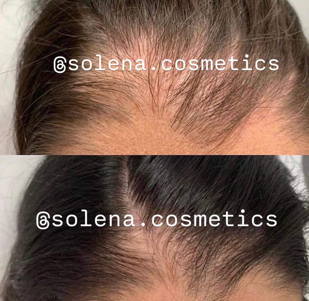 Le miracle des racines