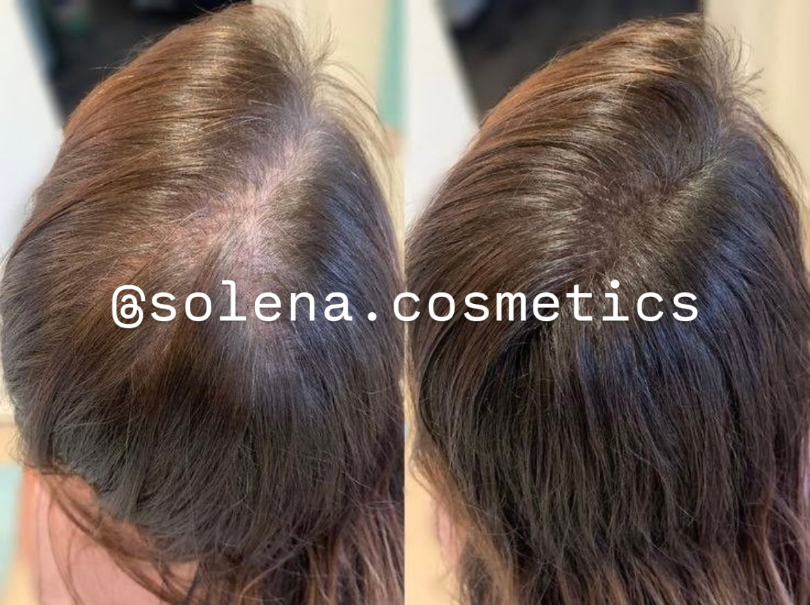 Le miracle des racines